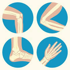 A térd artritiszének kezelésére szolgáló módszer
